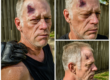 Motorcycle Brain Injury